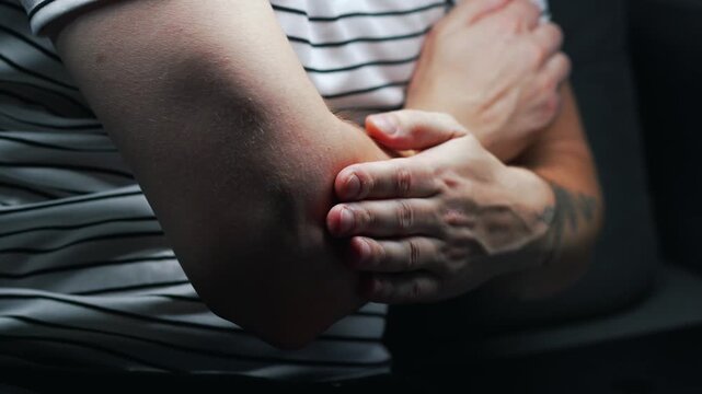 elbow contusion