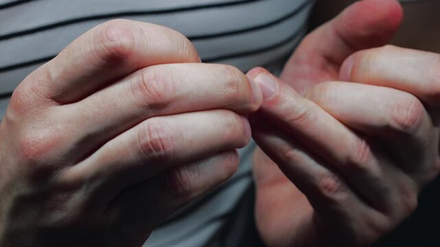 Fingernails on a man's hand