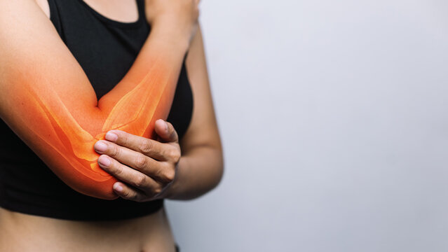 Woman with Elbow Pain and Inflamed Joint, Highlighted Arm Bones Illustrating Arthritis, Injury and Musculoskeletal Healthcare