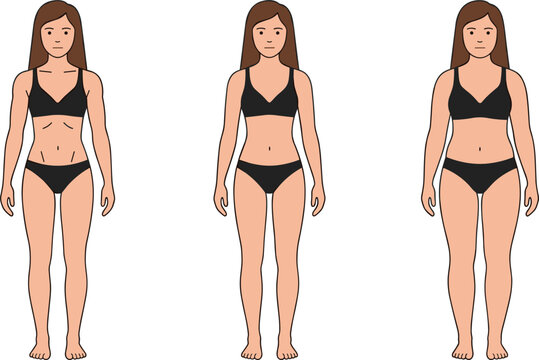 Anorexia nervosa to healthy body and weight gain obesity scale female medical vector illustration isolated on white