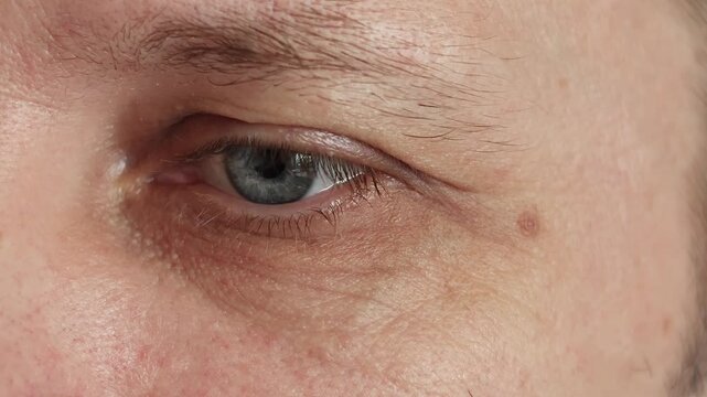 Wrinkles around man's eye forming and smoothing. Concept of natural aging skin texture after forty, crow&rsquo;s feet movement. Close-up of facial expression detail