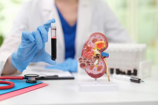 Blue gloved hand presents blood tube near detailed kidney model on clean desk, with blurred clinician in background, stethoscope, and lab materials, illustrating nephrology testing, patient care