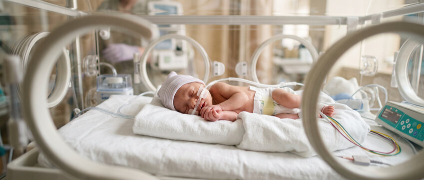 Premature newborn baby girl resting peacefully, representing neonatal care, early birth, infant health, medical support and the delicate first days of life.