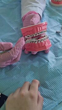 Hand application of dental braces in a dental clinic setting