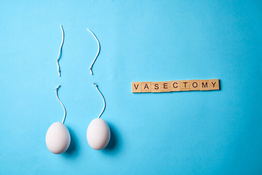 Male sterilization procedures vasectomy and tubal ligation healthcare