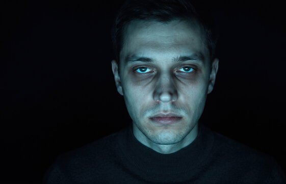 Close Up of Exhausted Man with Severe Dark Circles Under Eyes in Dark Room