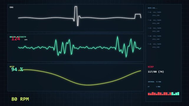 Medical monitor screen displaying EKG and brain activity waves in hospital environment.