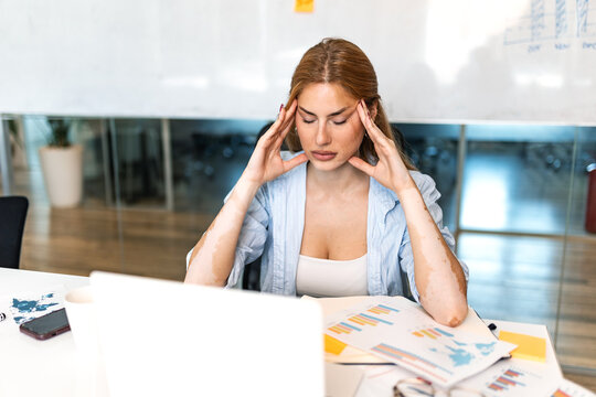 Business woman suffering from headache in office. Tired female professional holding head with hands, feeling stressed at desk. Exhausted manager working with laptop, financial charts, and documents.