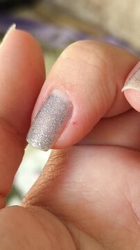 a damaged fingertip and nail area, representing the consequences of nail biting, torn cuticles, hangnails and poor nail care.