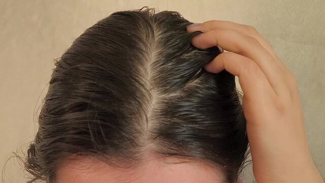 a woman touching oily hair at the roots, representing greasy scalp, active sebaceous glands, excess sebum and scalp care.