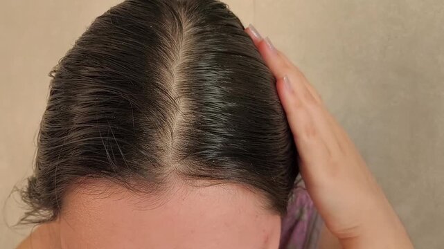 a woman touching oily hair at the roots, representing greasy scalp, active sebaceous glands, excess sebum and scalp care.