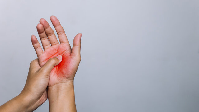 Woman Massaging Painful Palm Hand Carpal Tunnel Syndrome Concept
