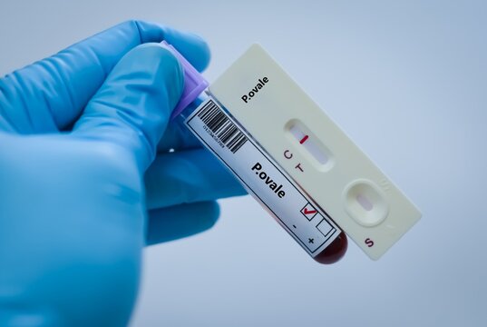 Blood sample tube of patient negative result for P.ovale