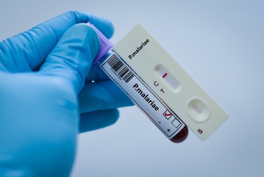 Blood sample tube of patient negative result for malariae.
