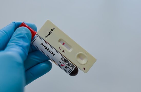 Blood sample tube of patient negative result for malariae.