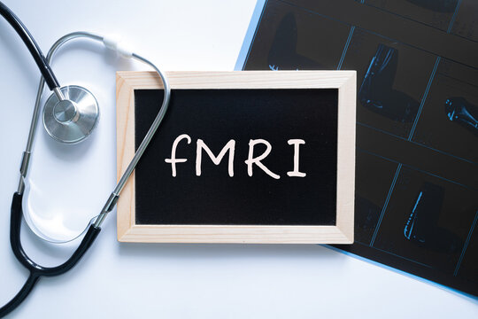 fMRI text on black chalkboard with stethoscope on white background, functional brain imaging and neuroscience concept