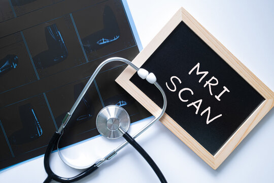 MRI Scan text on black chalkboard with stethoscope on dark background, medical imaging and diagnostic concept
