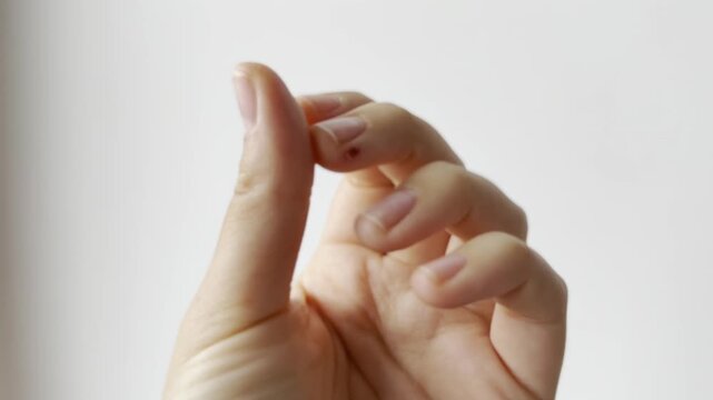 Horizontal video. Close-up shot of a human hand showing a small cut or wound on a finger, displaying injured skin and injury care.