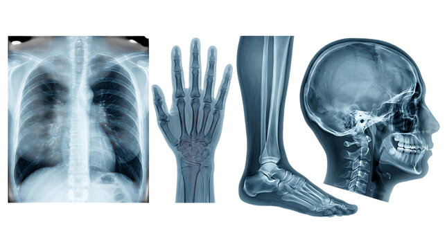 Collection of various human body part xray scans isolated on transparent background