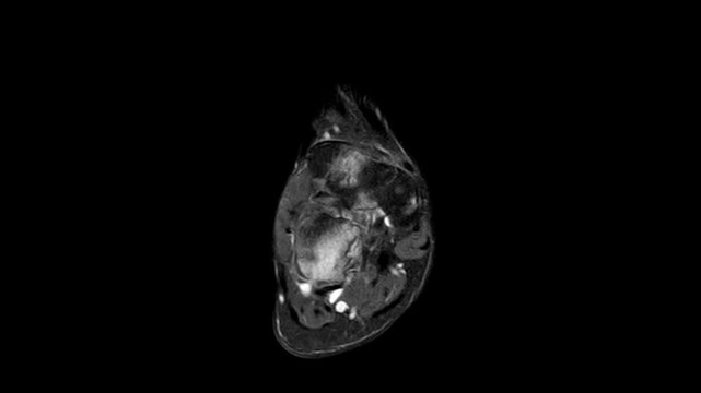 Axial MRI Scan of Human Ankle Joint and Tarsal Bones