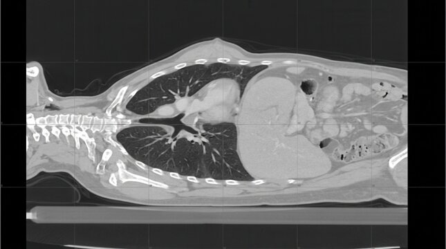 Monochromatic sagittal CT scan of the human torso, showcasing the lungs, heart, spine, and abdominal organs in detailed cross-section.