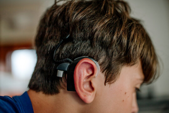 Close-Up of Teenager Wearing a Cochlear Implant