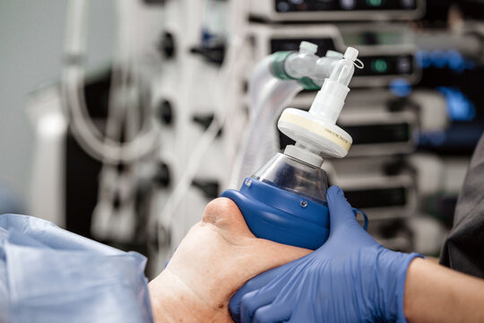Close-up of oxygen and ventilation support provided to a patient during anesthesia in the operating room.