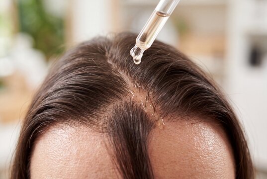 Applying Hair Growth Serum with Dropper to Female Scalp for Treatment