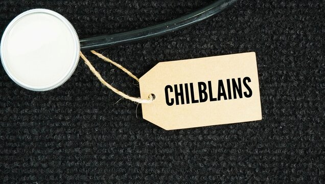 Stethoscope and paper tag with the word Chilblains. small, itchy, painful red or purple swellings on the skin caused by an abnormal vascular reaction to cold, damp conditions