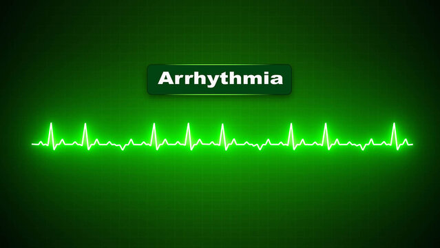 Green Neon Electrocardiogram Pulse Trace with Arrhythmia Text on Grid Screen