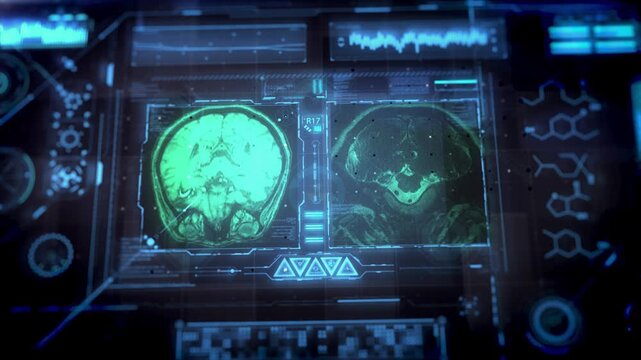 Futuristic digital brain scan analysis on a high tech medical interface.