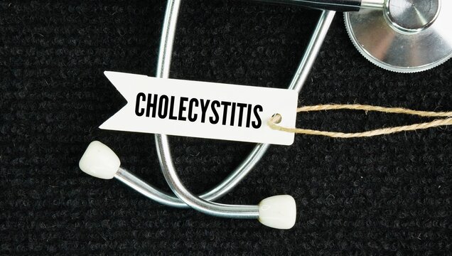 Stethoscope and paper tag with the word Cholecystitis is the inflammation and swelling of the gallbladder, a small pear-shaped organ under the liver that stores digestive bile, most commonly caused 