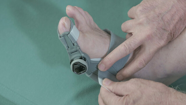 Close-up of a person using a toe corrector brace to help maintain proper big toe alignment and provide support for foot positioning and comfort.