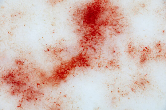 A red stain on a white surface