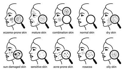 Fototapeta premium Skin types dermatology vector icon set featuring female faces with magnifying glass analyzing various conditions isolated on white.