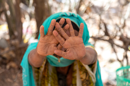 Woman covering her face with hands, Artuma, Ethiopia