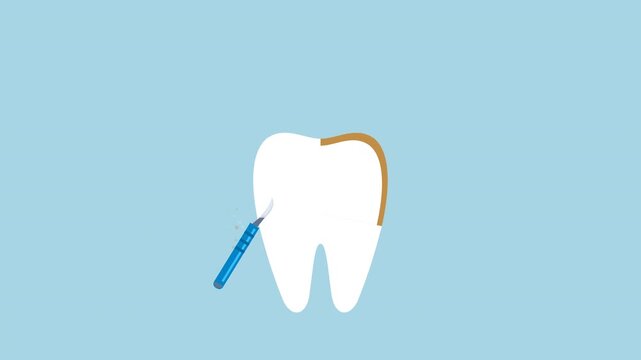 Clean human tooth from plaque illustration