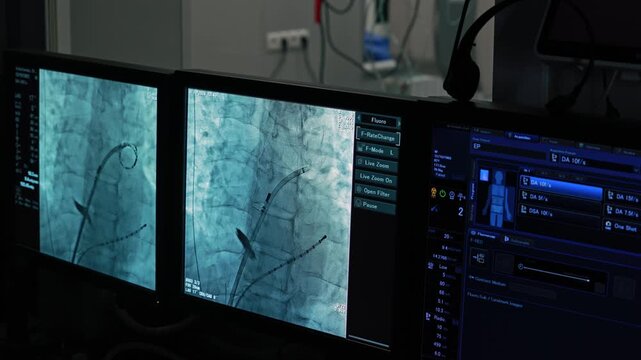 Cath lab monitors showing live fluoroscopy of catheters inside the heart during cardiac catheterization, contrast injection on x-ray screen, no people. Medical AI workflow