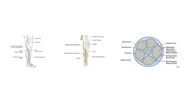 Human Peroneal Nerve Anatomy Vector Illustration with Simple Outline, Filled and Cross-Section Views, Detailed Common Fibular Nerve, Leg, Ankle and Foot Pathway for Medical Education
