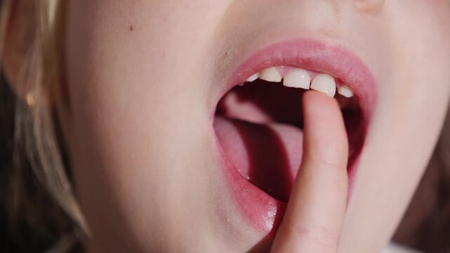 Close-up of child's mouth with finger exploring loose baby tooth.