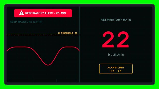 Premium 2D flat vector medical animation featuring a digital respiratory rate monitor with symmetrical layout, breaths-per-minute measurement, animated breathing waveform, threshold marker, and automa
