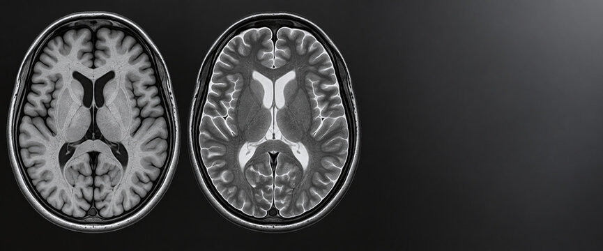 Brain MRI Weighting Comparison With Copy Space