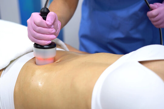Safe skin shaping. Clinic professional administers noninvasive body sculpting procedure