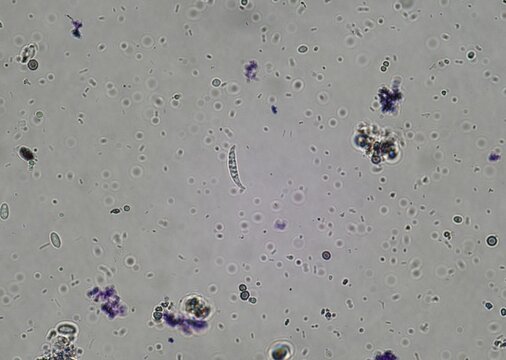 soil microorganisms under a microscope including amoeba, flagellates, nematodes, fungi, bacteria