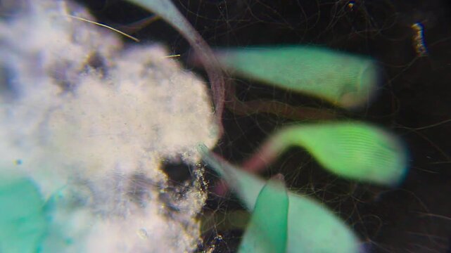 Close-up of blue-green Stentor ciliates attached to detritus under 100x darkfield microscopy