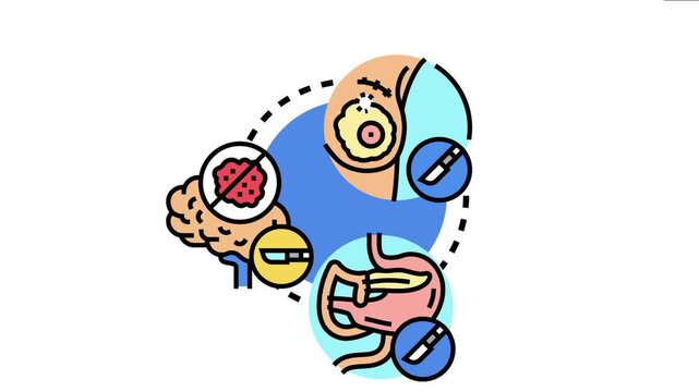 Oncology surgery concept various operations like breast tumor removal, brain cancer excision, and pancreatic disease treatment, representing medical intervention for malignancy