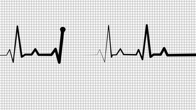 Digital ECG Line Animation for Medical and Healthcare Presentations