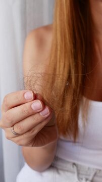 Close-up of woman holding fallen hair after brushing showing excessive hair loss and shedding problem
