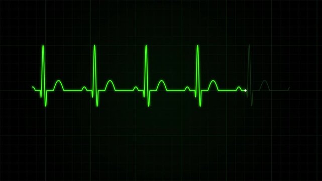 Heartbeat signal displays rhythmic pulses on a dark green medical monitor screen pulse ecg cardiology