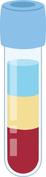 Medical laboratory glassware showing a centrifuged blood sample with distinct layers, illustrating a scientific diagnostic process in a healthcare environment.